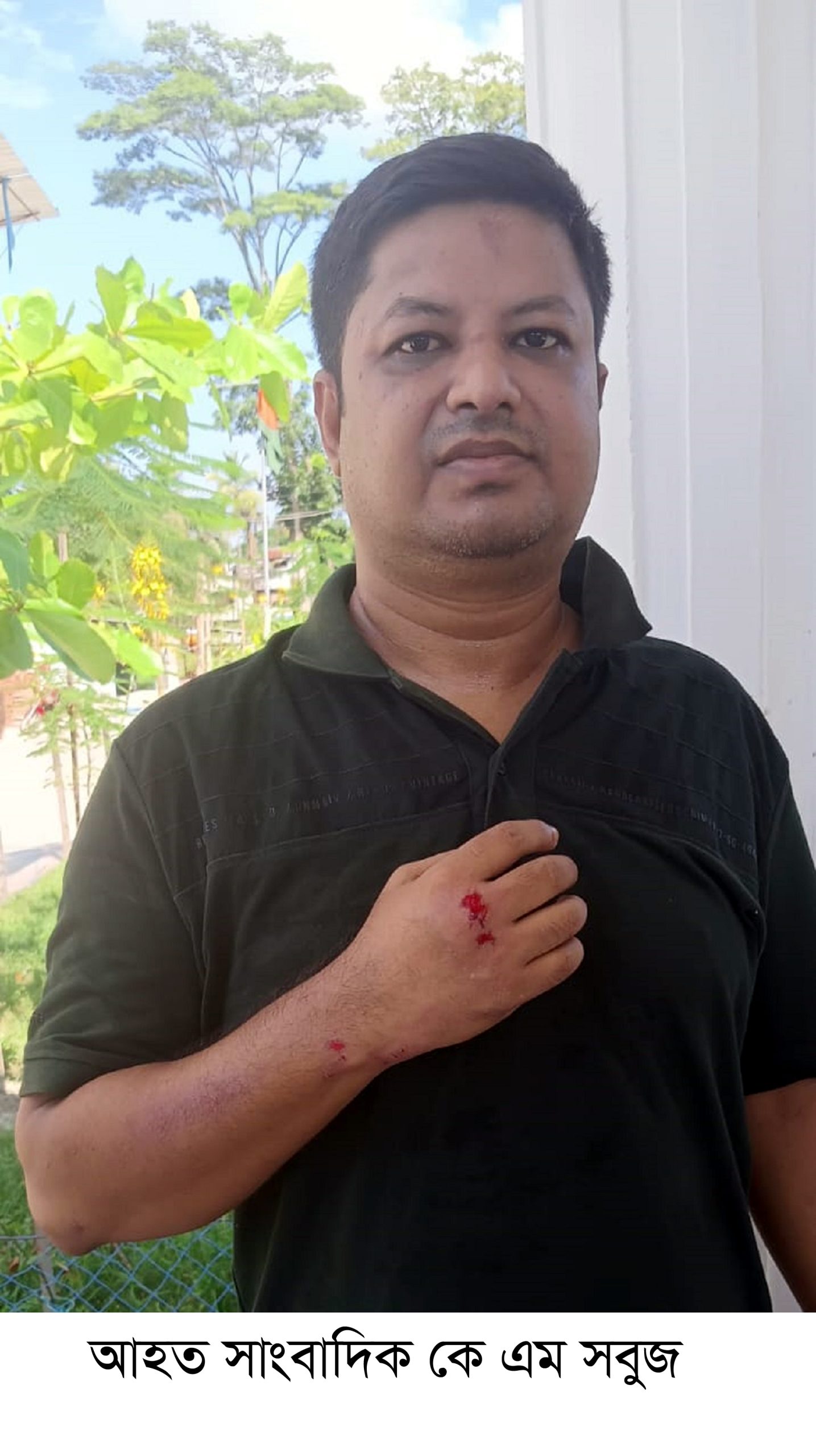 নলছিটি প্রেস ক্লাবের সাধারণ সম্পাদক সাংবাদিক কে এম সবুজের ওপর হামলা।